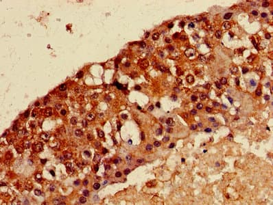 Polyclonal Rabbit anti-Human MAGEA8 Antibody