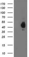 PDHA1 / PDH E1 Alpha Antibody (clone OTI2B10)