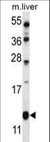 GOLT1B Antibody (aa108-136)