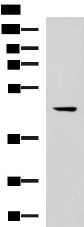 MLNR/GPR38/Motilin Receptor Antibody