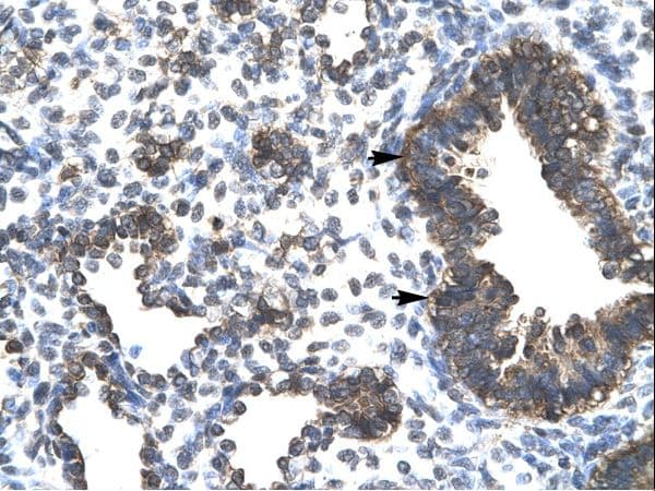 ESRRG / ERR Gamma Antibody (aa190-239)
