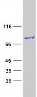 Human ESRP2 / RBM35B Protein (Recombinant Myc-DDK (Flag))