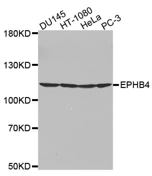 EPHB4 / EPH Receptor B4 Antibody