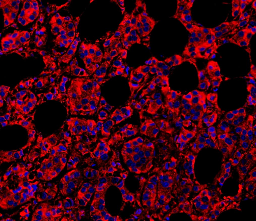 Polyclonal Rabbit anti-Human MYD88 Antibody (aa44-264, IHC, WB)