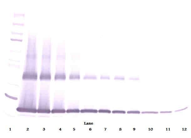 IL-1B / IL-1 Beta Antibody