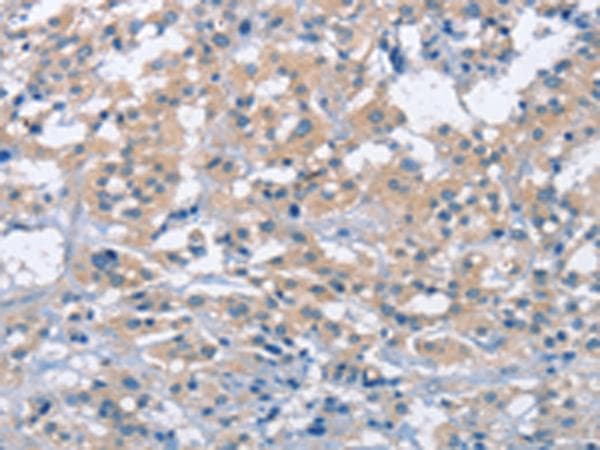ZAP70 Antibody