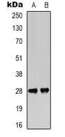 BCL2 / Bcl-2 Antibody (phospho-Thr56)