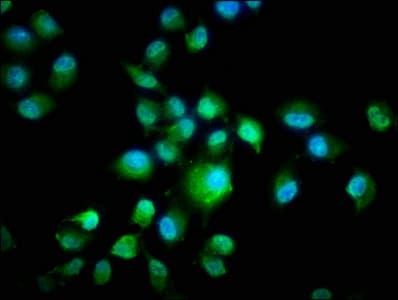 CSNK1E / CK1 Epsilon Antibody (aa1-416)