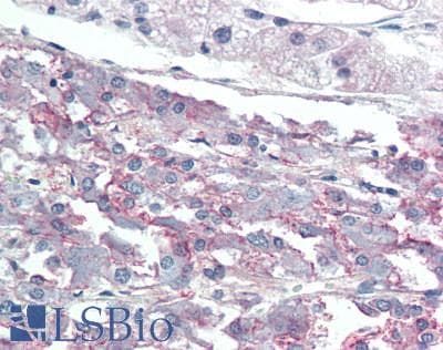 IHC-plus™ RAMP3 Antibody