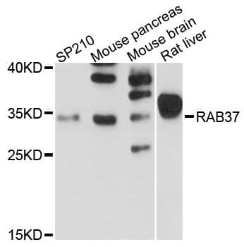 Polyclonal Rabbit anti-Human RAB37 Antibody (WB)
