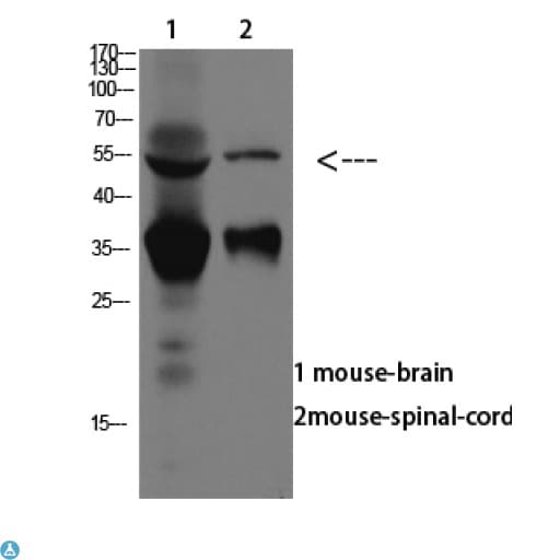 ASIC1 / ACCN2 Antibody