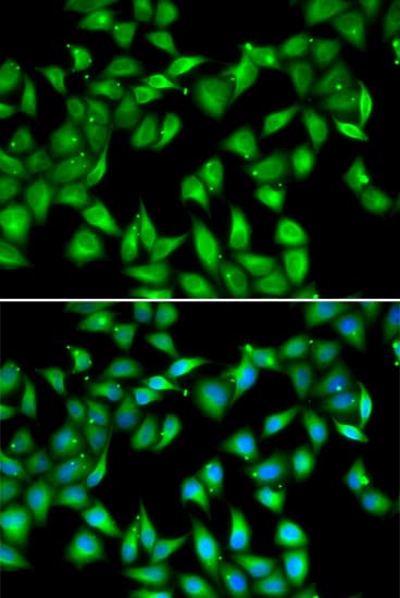 MYL3 Antibody