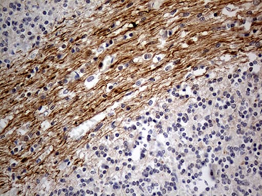 NEFH / NF-H Antibody (aa778-1020, clone OTI7E4)