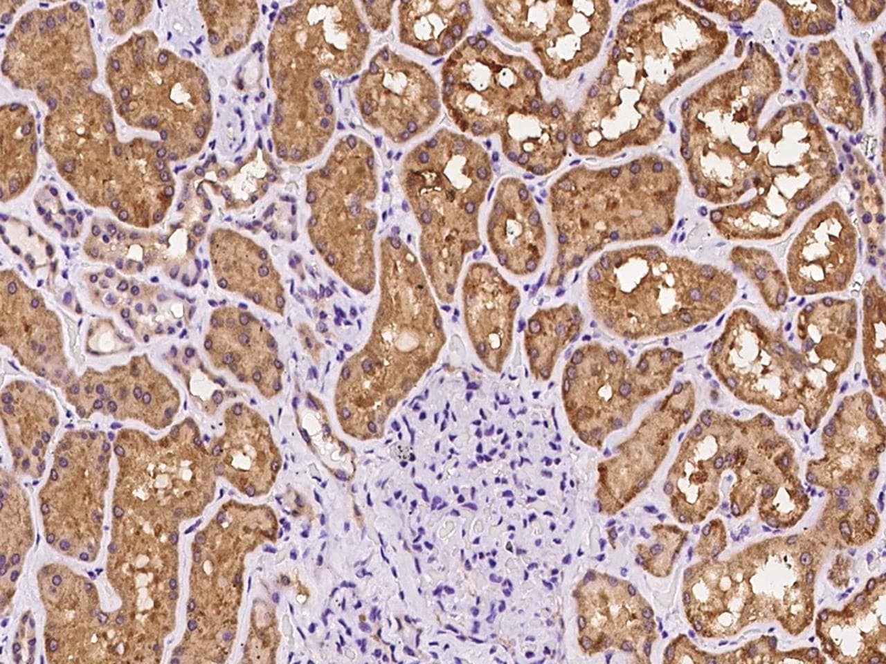 SLC26A6 / PAT1 Antibody