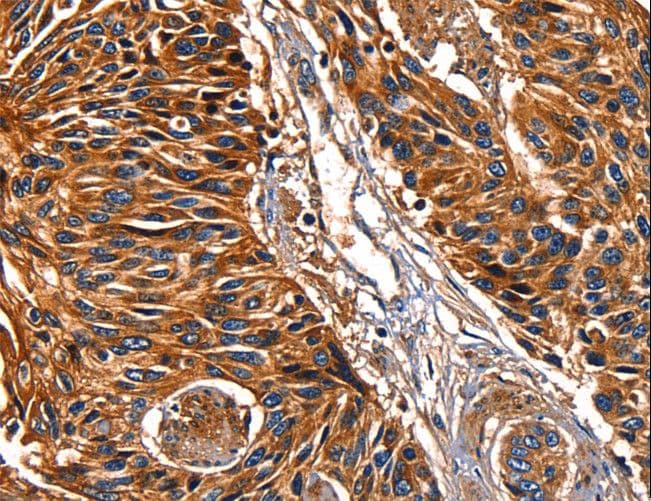 Polyclonal Rabbit anti-Human LGALS8 / Galectin 8 Antibody (IHC)