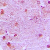 MRE11A / MRE11 Antibody (Internal)