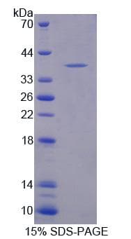 Mouse HMGCL Protein (Recombinant)