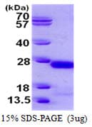 Human CRYGC / CCL Protein (Recombinant His)