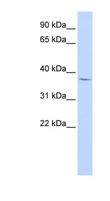 FOXB1 Antibody (aa91-140)