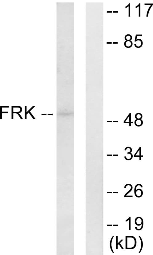FRK Antibody (aa71-120)