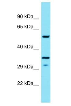 HSD11B1L Antibody (aa248-297)