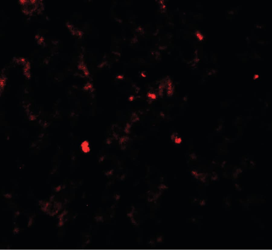 PDGF-BB Antibody