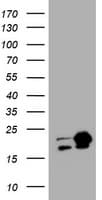 NME1 / NM23 Antibody (clone OTI4H2)