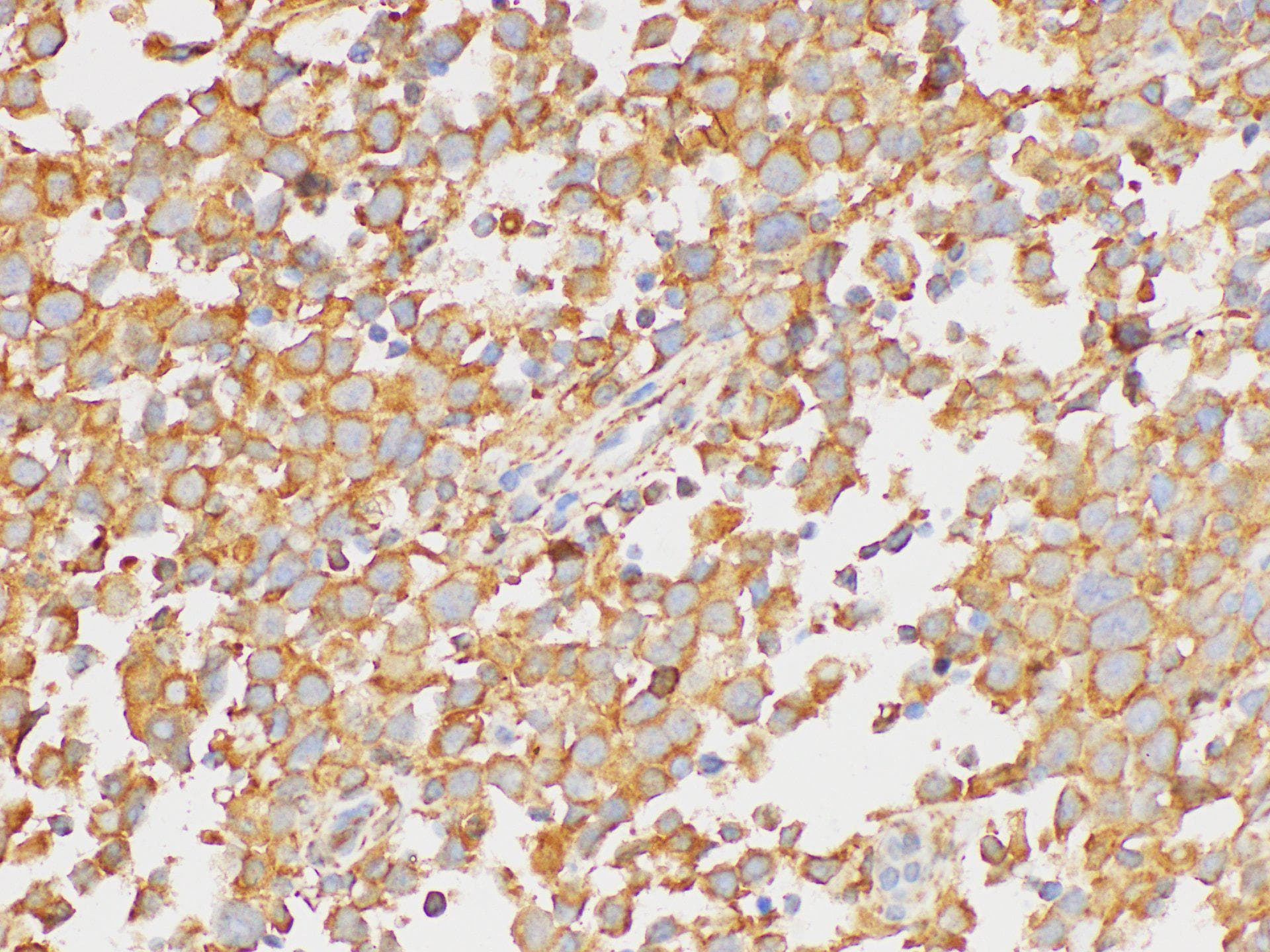 Polyclonal Rabbit anti-Human PAIP1 Antibody (IHC)