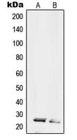 RPL10L Antibody (C-Terminus)