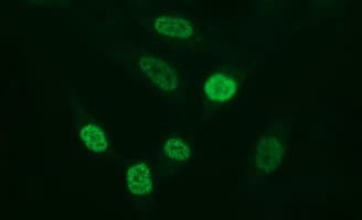 MMP13 Antibody (aa104-471, clone OTI3A7, Carrier-free)