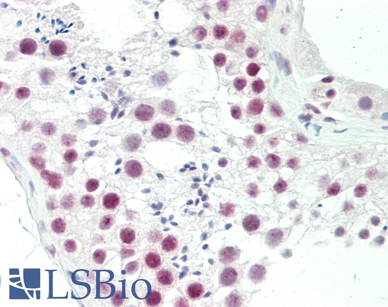 IHC-plus™ OLIG3 Antibody (aa74-100)