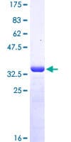 Human MSRB2 / MSRB Protein (Recombinant GST, N-terminus)