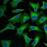 Monoclonal Mouse anti-Human EGFR Antibody (IHC, IF, WB)