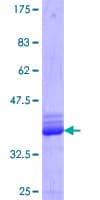 Human Epsin 1 / EPN1 Protein (Recombinant GST, N-terminus)