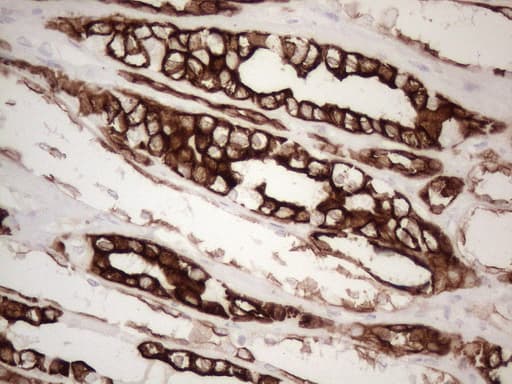 KRT16 / CK16 / Cytokeratin 16 Antibody (clone OTI2H8)
