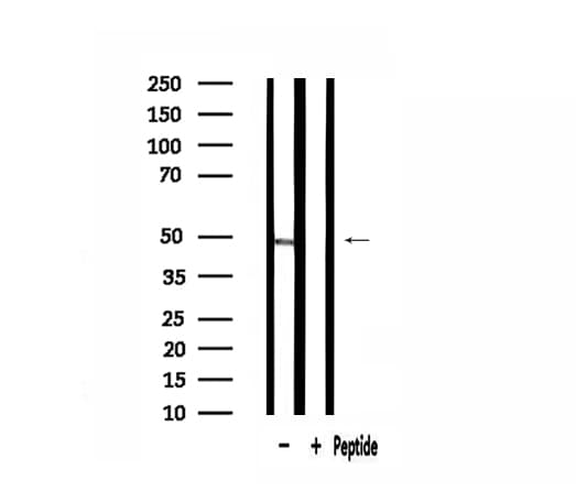 Polyclonal Rabbit anti-Human RPL3 / Ribosomal Protein L3 Antibody (IHC, IF, WB)