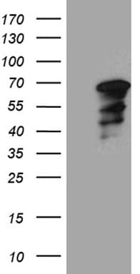 Monoclonal Mouse anti-Human WASL / N-WASP Antibody (clone OTI6A4, Carrier-free, IHC, WB)