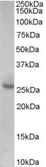 IHC-plus™ Polyclonal Goat anti-Human CDKN1B / p27 Kip1 Antibody (aa153-165, IHC, WB)