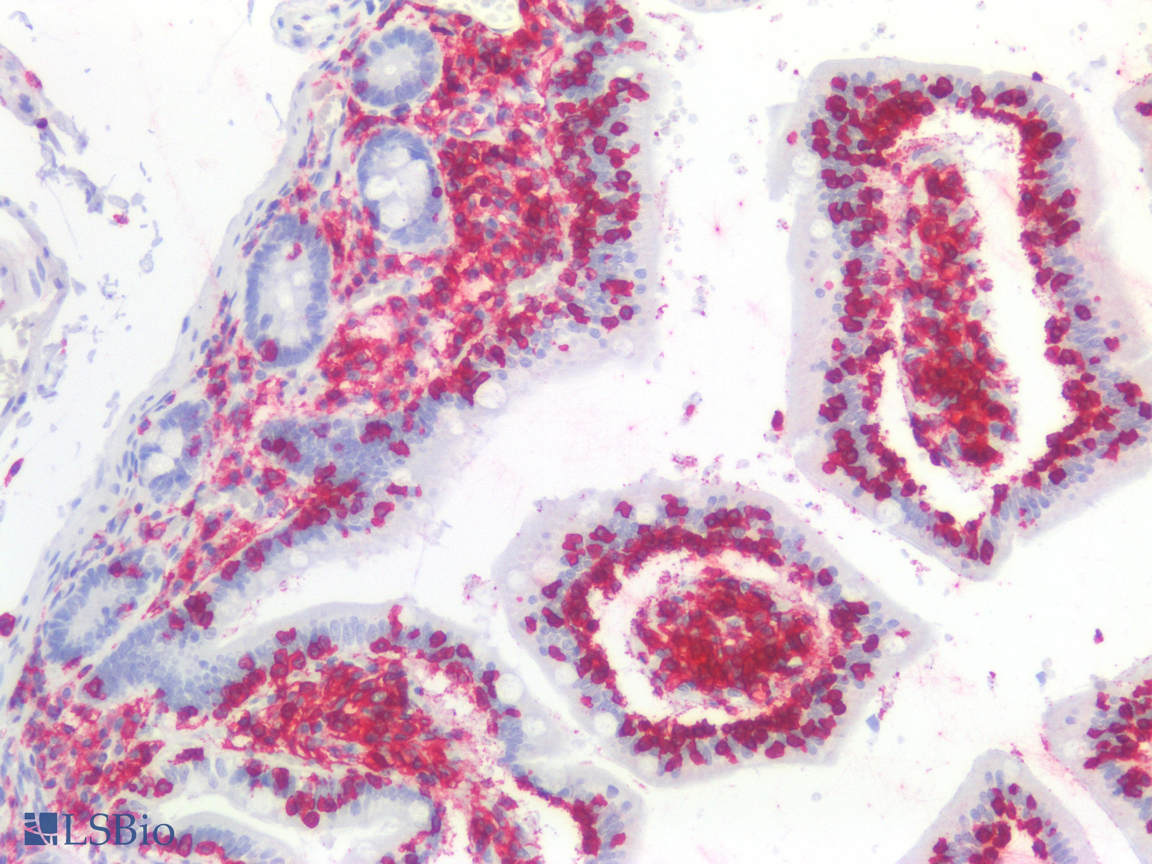Monoclonal Mouse anti-Human CD45 / LCA Antibody (clone MEM-28, IHC, WB)
