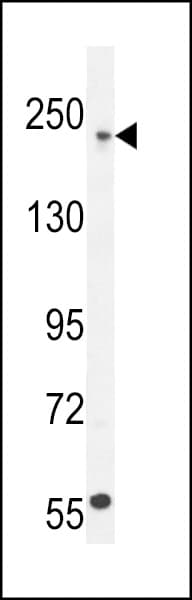 Polyclonal Rabbit anti-Human COL5A1 / Collagen V Alpha 1 Antibody (aa54-82, IHC, WB)