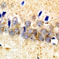 Polyclonal Rabbit anti-Human SORT1 / Sortilin Antibody (IHC, WB)