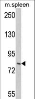 HRS / HGS Antibody (aa256-286)