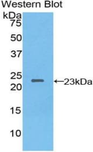 NME3 Antibody (aa1-168)