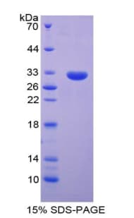 Rat RNF112 / ZNF179 Protein (Recombinant His-T7)