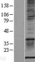 S100A1 / S100-A1 Protein (Over-Expression Lysate Myc-DDK (Flag))