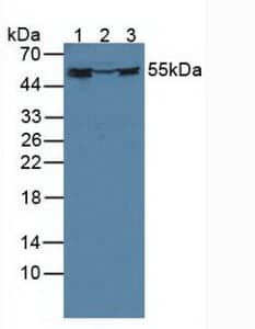 FKBP4 / FKBP52 Antibody (aa2-459)