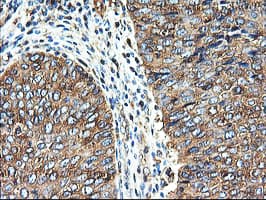 TUBAL3 Antibody (aa150-446, clone OTI2F6, Carrier-free)