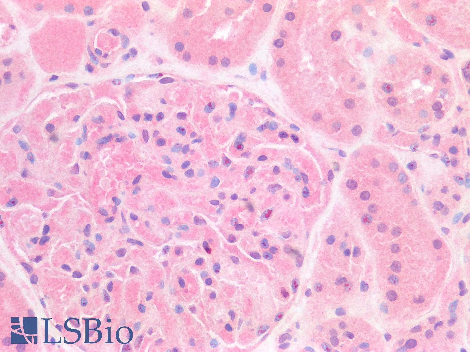 IHC-plus™ FOXC1 Antibody