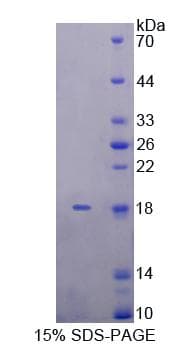 Rat KLRK1 / CD314 / NKG2D Protein (Recombinant His-T7)