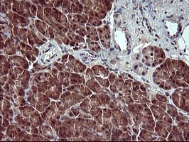 Placental Lactogen Antibody (clone OTI2G4)